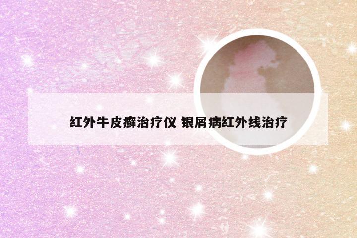 红外牛皮癣治疗仪 银屑病红外线治疗