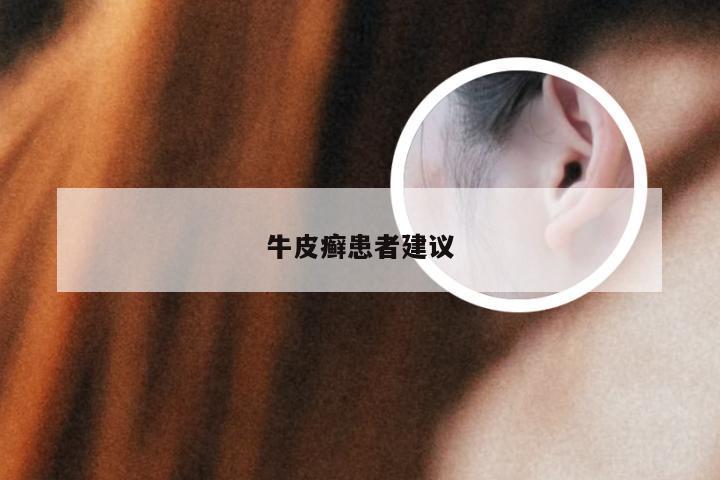 牛皮癣患者建议