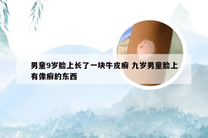 男童9岁脸上长了一块牛皮癣 九岁男童脸上有像癣的东西