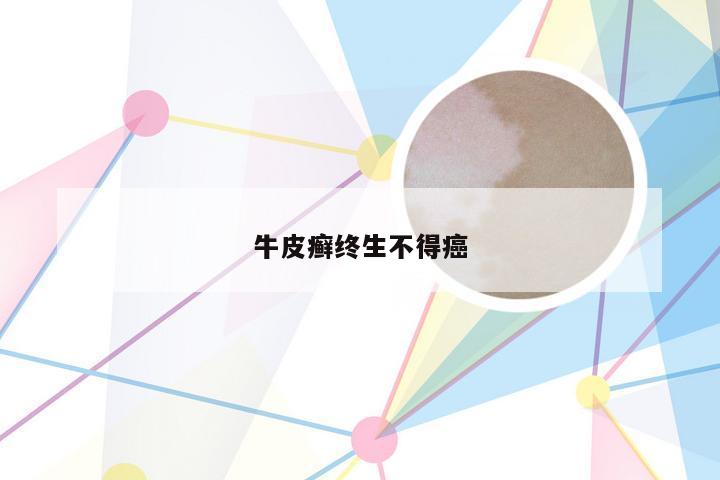 牛皮癣终生不得癌