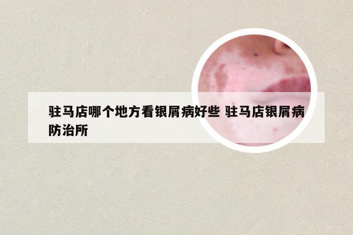 驻马店哪个地方看银屑病好些 驻马店银屑病防治所