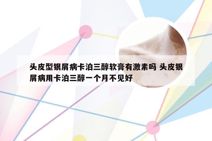 头皮型银屑病卡泊三醇软膏有激素吗 头皮银屑病用卡泊三醇一个月不见好