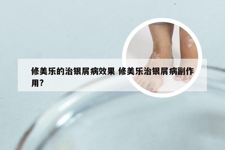 修美乐的治银屑病效果 修美乐治银屑病副作用?