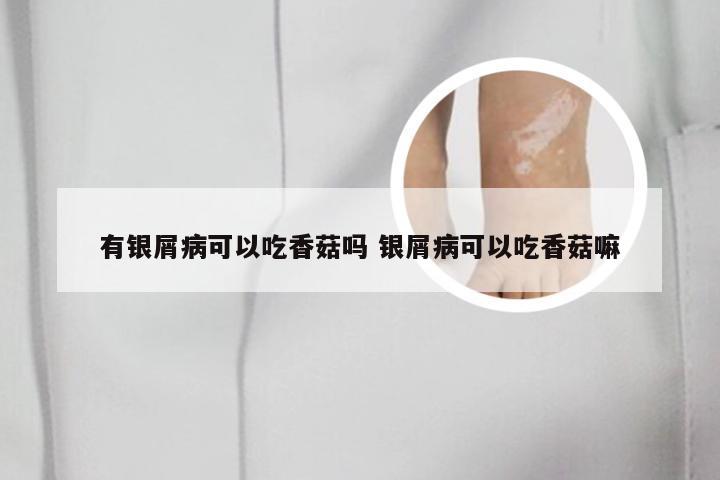有银屑病可以吃香菇吗 银屑病可以吃香菇嘛