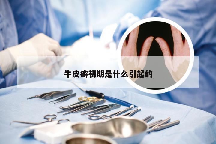 牛皮癣初期是什么引起的