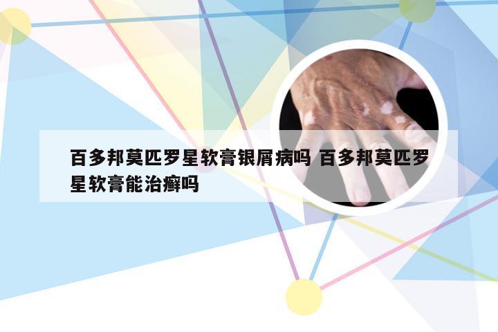 百多邦莫匹罗星软膏银屑病吗 百多邦莫匹罗星软膏能治癣吗