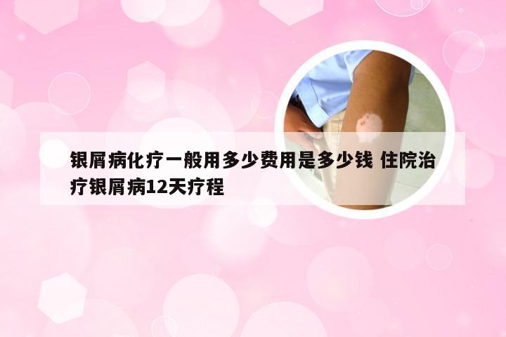 银屑病化疗一般用多少费用是多少钱 住院治疗银屑病12天疗程