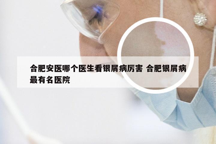 合肥安医哪个医生看银屑病厉害 合肥银屑病最有名医院