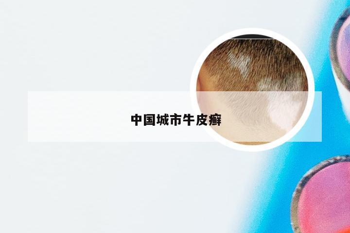 中国城市牛皮癣