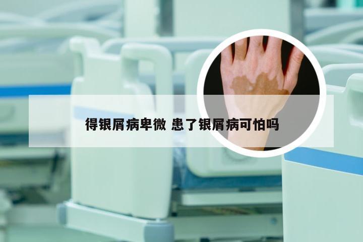 得银屑病卑微 患了银屑病可怕吗