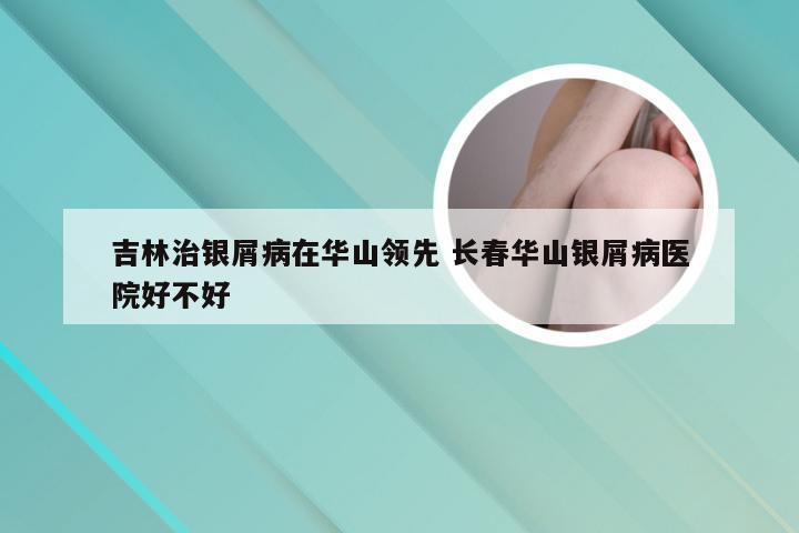 吉林治银屑病在华山领先 长春华山银屑病医院好不好