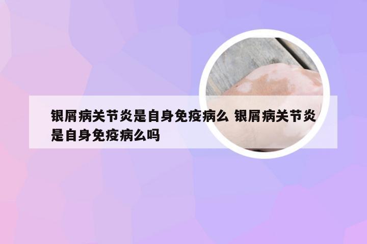 银屑病关节炎是自身免疫病么 银屑病关节炎是自身免疫病么吗