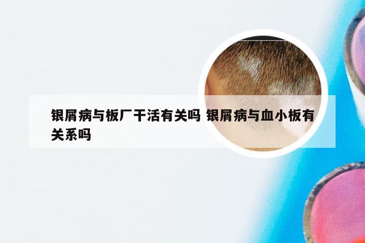 银屑病与板厂干活有关吗 银屑病与血小板有关系吗