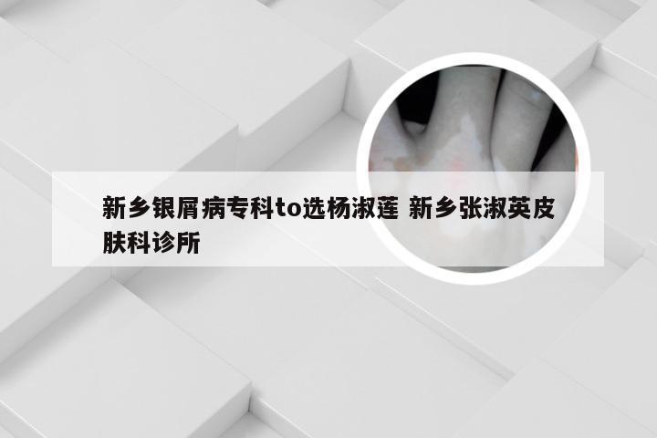 新乡银屑病专科to选杨淑莲 新乡张淑英皮肤科诊所