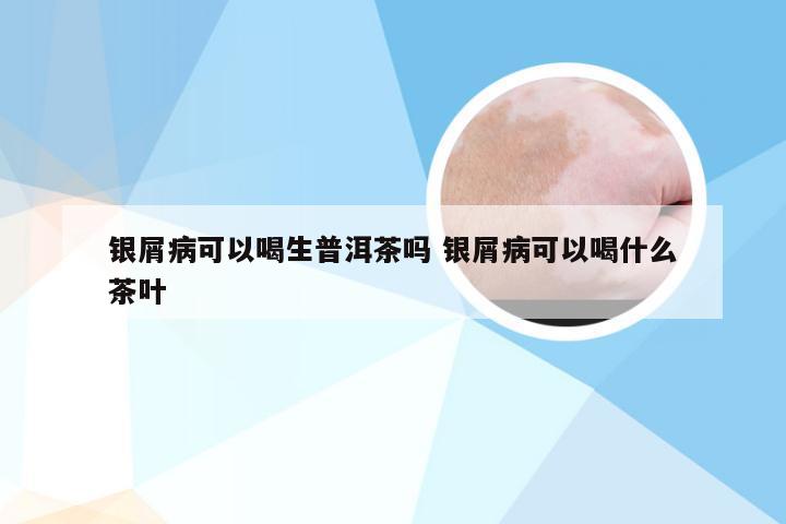 银屑病可以喝生普洱茶吗 银屑病可以喝什么茶叶