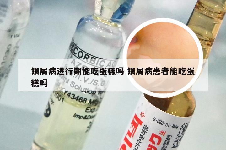 银屑病进行期能吃蛋糕吗 银屑病患者能吃蛋糕吗