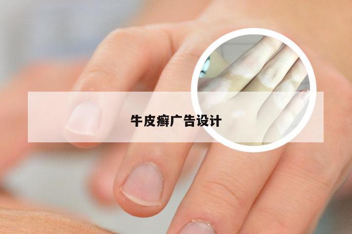 牛皮癣广告设计
