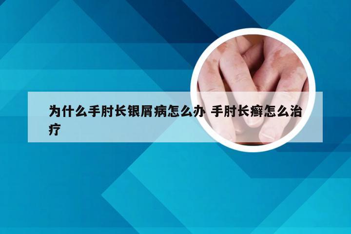为什么手肘长银屑病怎么办 手肘长癣怎么治疗
