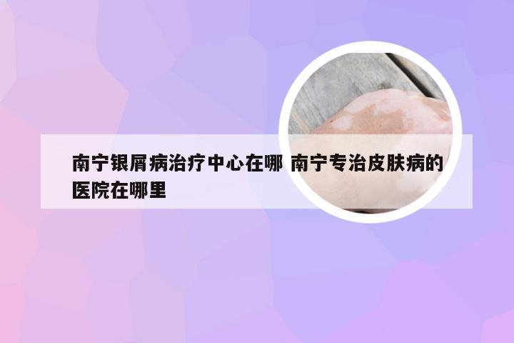 南宁银屑病治疗中心在哪 南宁专治皮肤病的医院在哪里