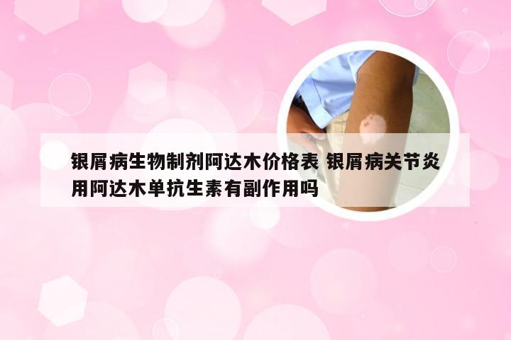 银屑病生物制剂阿达木价格表 银屑病关节炎用阿达木单抗生素有副作用吗