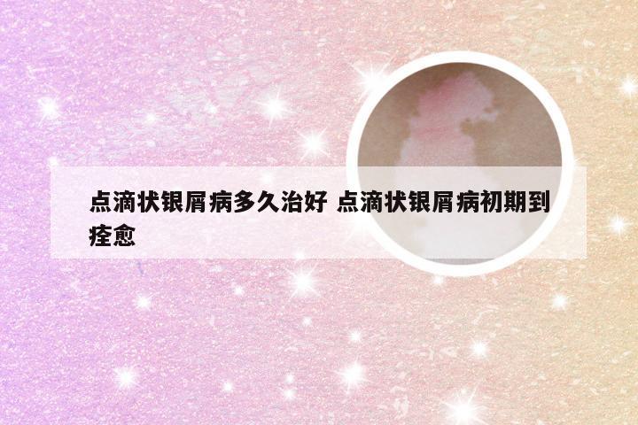 点滴状银屑病多久治好 点滴状银屑病初期到痊愈