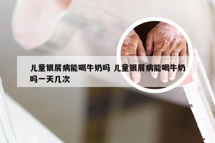 儿童银屑病能喝牛奶吗 儿童银屑病能喝牛奶吗一天几次