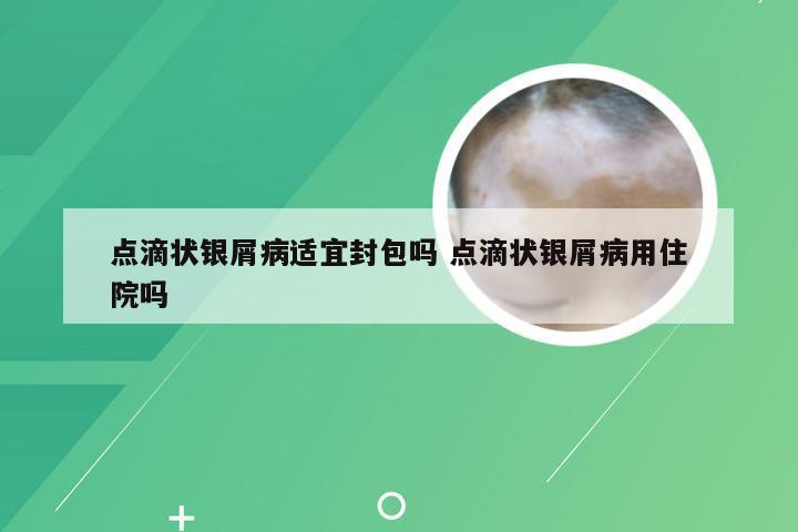 点滴状银屑病适宜封包吗 点滴状银屑病用住院吗