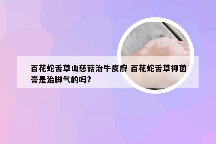 百花蛇舌草山慈菇治牛皮癣 百花蛇舌草抑菌膏是治脚气的吗?