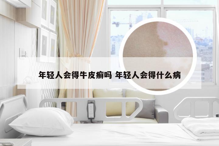 年轻人会得牛皮癣吗 年轻人会得什么病