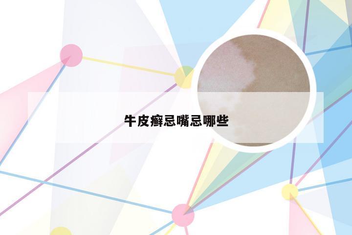 牛皮癣忌嘴忌哪些