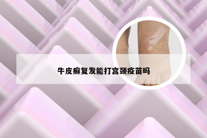 牛皮癣复发能打宫颈疫苗吗