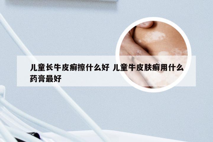 儿童长牛皮癣擦什么好 儿童牛皮肤癣用什么药膏最好