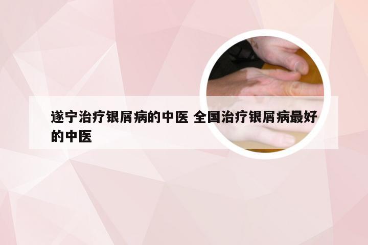 遂宁治疗银屑病的中医 全国治疗银屑病最好的中医
