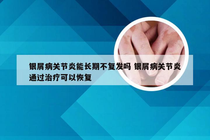 银屑病关节炎能长期不复发吗 银屑病关节炎通过治疗可以恢复