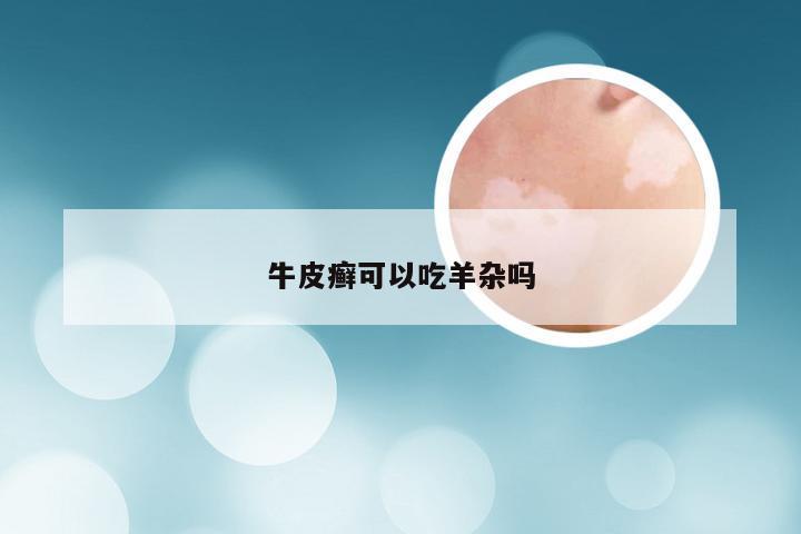 牛皮癣可以吃羊杂吗