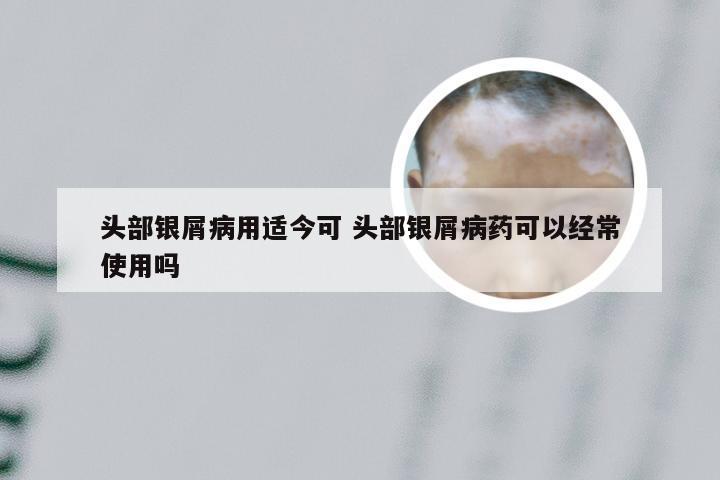 头部银屑病用适今可 头部银屑病药可以经常使用吗