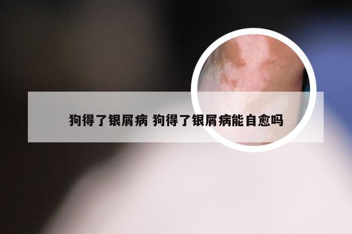狗得了银屑病 狗得了银屑病能自愈吗
