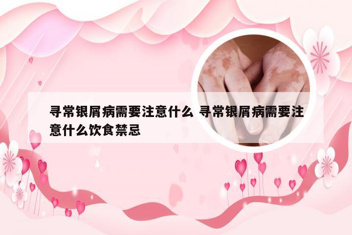 寻常银屑病需要注意什么 寻常银屑病需要注意什么饮食禁忌