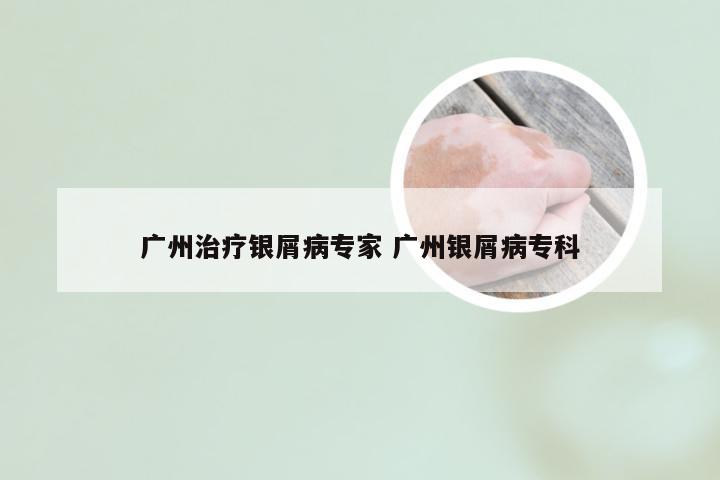 广州治疗银屑病专家 广州银屑病专科