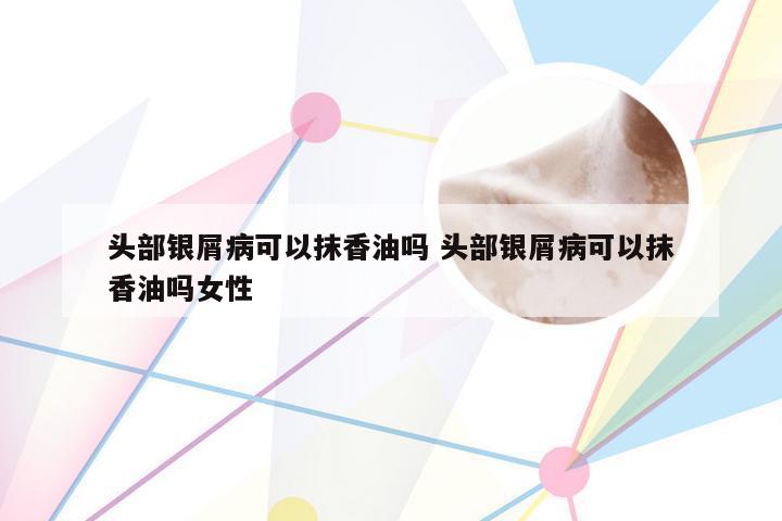 头部银屑病可以抹香油吗 头部银屑病可以抹香油吗女性