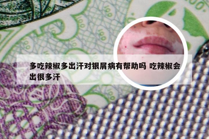 多吃辣椒多出汗对银屑病有帮助吗 吃辣椒会出很多汗