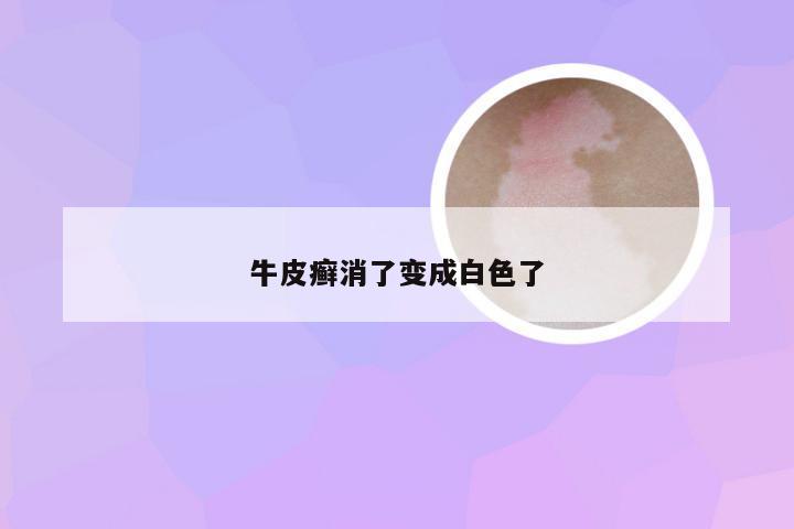 牛皮癣消了变成白色了