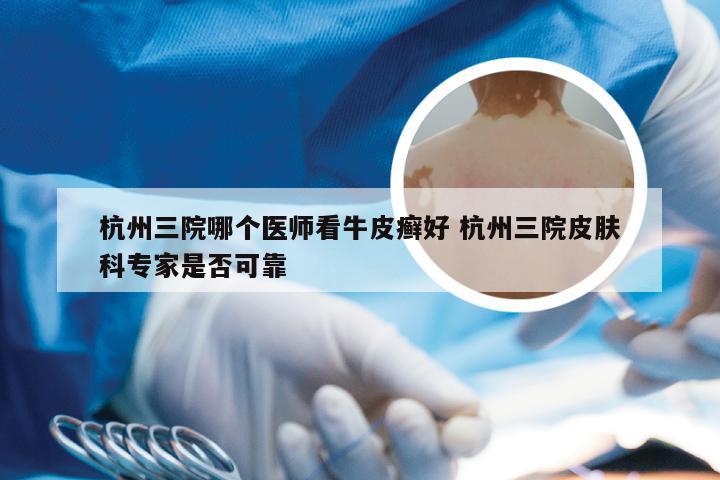 杭州三院哪个医师看牛皮癣好 杭州三院皮肤科专家是否可靠