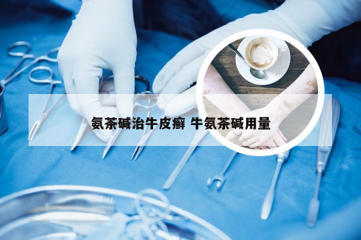 氨茶碱治牛皮癣 牛氨茶碱用量