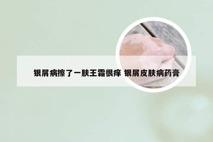 银屑病擦了一肤王霜很痒 银屑皮肤病药膏