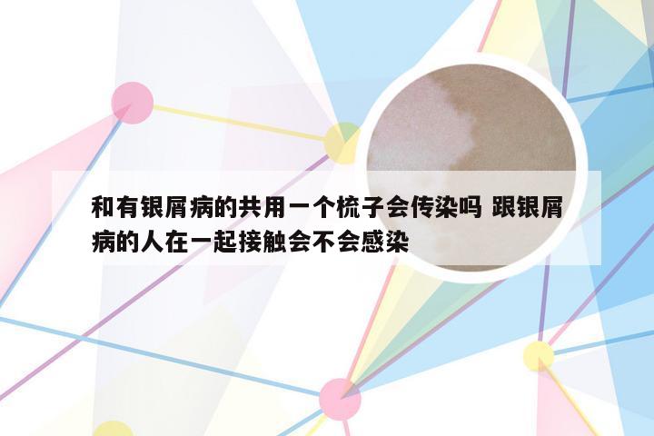 和有银屑病的共用一个梳子会传染吗 跟银屑病的人在一起接触会不会感染