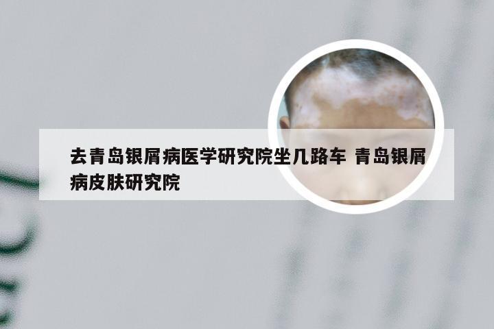去青岛银屑病医学研究院坐几路车 青岛银屑病皮肤研究院