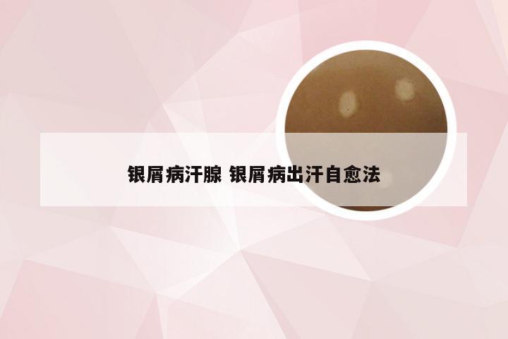 银屑病汗腺 银屑病出汗自愈法
