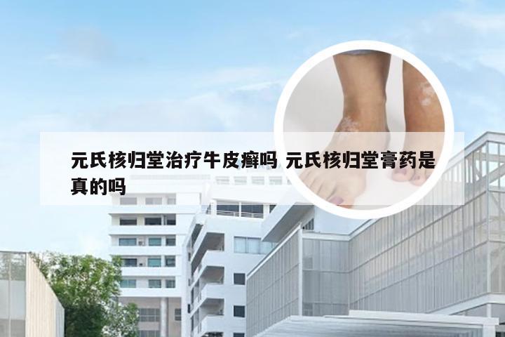 元氏核归堂治疗牛皮癣吗 元氏核归堂膏药是真的吗
