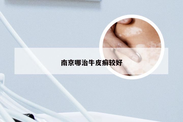 南京哪治牛皮癣较好